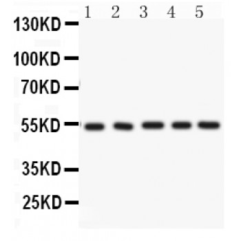 ARSA / Arylsulfatase A Antibody - ARSA antibody Western blot. All lanes: Anti ARSA at 0.5 ug/ml. Lane 1: Rat Testis Tissue Lysate at 50 ug. Lane 2: Rat Pancreas Tissue Lysate at 50 ug. Lane 3: Rat Skeletal Muscle Tissue Lysate at 50 ug. Lane 4: Mouse Kidney Tissue Lysate at 50 ug. Lane 5: MCF-7 Whole Cell Lysate at 40 ug. Predicted band size: 54 kD. Observed band size: 54 kD.
