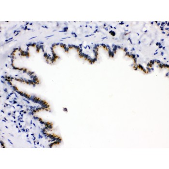 ARSA / Arylsulfatase A Antibody - ARSA antibody IHC-paraffin. IHC(P): Rat Lung Tissue.