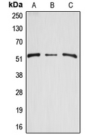 ARSA / Arylsulfatase A Antibody - Western blot analysis of Arylsulfatase A expression in HEK293T (A); mouse kidney (B); rat kidney (C) whole cell lysates.