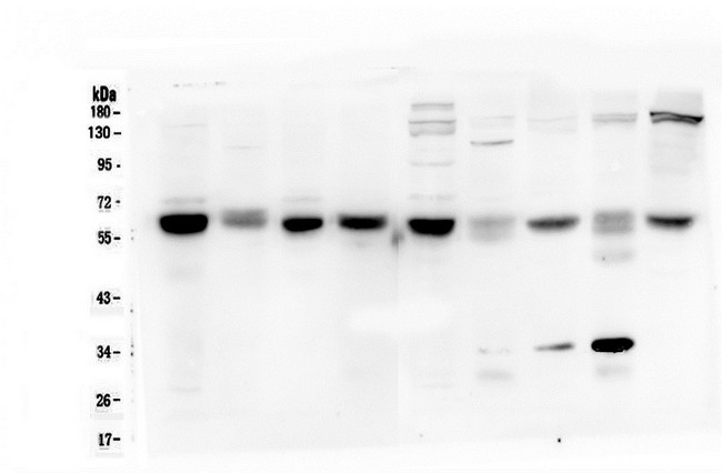 ARSA / Arylsulfatase A Antibody - Western blot analysis of ARSA using anti-ARSA antibody. Electrophoresis was performed on a 10% SDS-PAGE gel at 70V (Stacking gel) / 90V (Resolving gel) for 2-3 hours. The sample well of each lane was loaded with 50ug of sample under reducing conditions. Lane 1: rat testis tissue lysate,Lane 2: rat liver tissue lysate,Lane 3: rat brain tissue lysate,Lane 4: rat lung tissue lysate,Lane 5: mouse testis tissue lysate,Lane 6: mouse liver tissue lysate,Lane 7: mouse brain tissue lysate,Lane 8: mouse lung tissue lysate,Lane 9: mouse HEPA1-6 whole cell lysate. After Electrophoresis, proteins were transferred to a Nitrocellulose membrane at 150mA for 50-90 minutes. Blocked the membrane with 5% Non-fat Milk/ TBS for 1.5 hour at RT. The membrane was incubated with mouse anti-ARSA antigen affinity purified monoclonal antibody at 0.5 µg/mL overnight at 4°C, then washed with TBS-0.1% Tween 3 times with 5 minutes each and probed with a goat anti-mouse IgG-HRP secondary antibody at a dilution of 1:10000 for 1.5 hour at RT. The signal is developed using an Enhanced Chemiluminescent detection (ECL) kit with Tanon 5200 system.