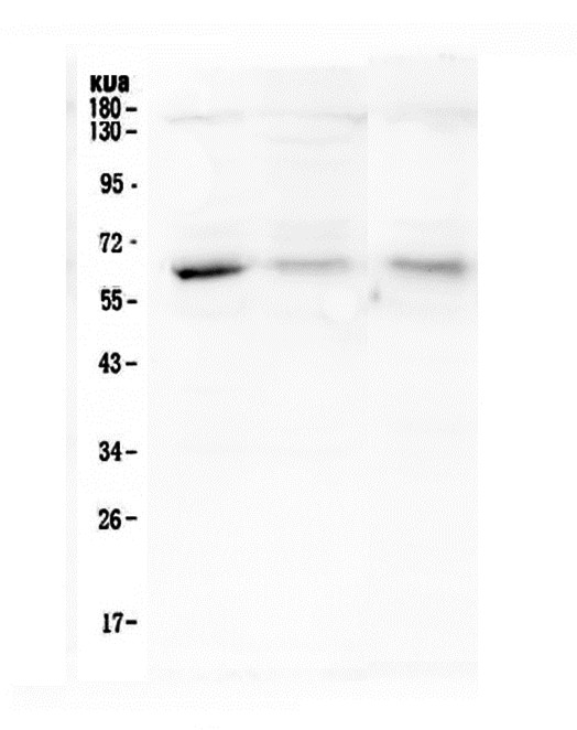 ARSA / Arylsulfatase A Antibody - Western blot analysis of ARSA using anti-ARSA antibody. Electrophoresis was performed on a 10% SDS-PAGE gel at 70V (Stacking gel) / 90V (Resolving gel) for 2-3 hours. The sample well of each lane was loaded with 50ug of sample under reducing conditions. Lane 1: human A375 whole cell lysate,Lane 2: human A549 whole cell lysate,Lane 3: human SMMC-7721 whole cell lysate. After Electrophoresis, proteins were transferred to a Nitrocellulose membrane at 150mA for 50-90 minutes. Blocked the membrane with 5% Non-fat Milk/ TBS for 1.5 hour at RT. The membrane was incubated with mouse anti-ARSA antigen affinity purified monoclonal antibody at 0.5 µg/mL overnight at 4°C, then washed with TBS-0.1% Tween 3 times with 5 minutes each and probed with a goat anti-mouse IgG-HRP secondary antibody at a dilution of 1:10000 for 1.5 hour at RT. The signal is developed using an Enhanced Chemiluminescent detection (ECL) kit with Tanon 5200 system.