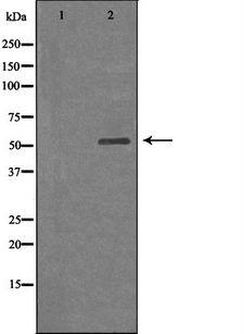 ARSA / Arylsulfatase A Antibody - Western blot analysis of extracts of Jurkat cells using ARSA antibody.