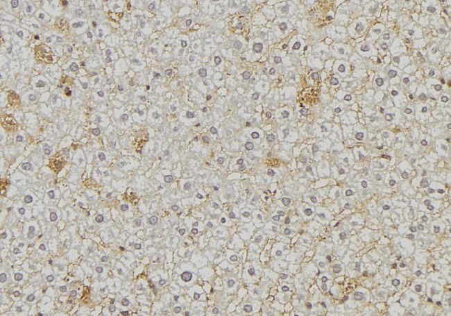 ARSA / Arylsulfatase A Antibody - 1:100 staining mouse liver tissue by IHC-P. The sample was formaldehyde fixed and a heat mediated antigen retrieval step in citrate buffer was performed. The sample was then blocked and incubated with the antibody for 1.5 hours at 22°C. An HRP conjugated goat anti-rabbit antibody was used as the secondary.
