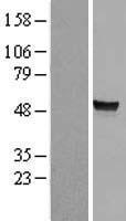 ARSA / Arylsulfatase A Protein - Western validation with an anti-DDK antibody * L: Control HEK293 lysate R: Over-expression lysate