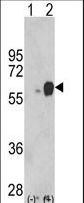 ARSB / Arylsulfatase B Antibody - Western blot of ARSB (arrow) using rabbit polyclonal ARSB Antibody. 293 cell lysates (2 ug/lane) either nontransfected (Lane 1) or transiently transfected with the ARSB gene (Lane 2) (Origene Technologies).