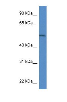 ARSB / Arylsulfatase B Antibody - ARSB antibody Western blot of Mouse Kidney lysate. Antibody concentration 1 ug/ml.  This image was taken for the unconjugated form of this product. Other forms have not been tested.