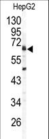 ARSB / Arylsulfatase B Antibody - Western blot of ARSB antibody in HepG2 cell line lysates (35 ug/lane). ARSB (arrow) was detected using the purified antibody.