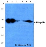 ARSB / Arylsulfatase B Antibody - Western blot of ARSB antibody at 1:500 dilution. Lane 1: HEK293T whole cell lysate. Lane 2: sp2/0 whole cell lysate. Lane 3: H9C8 whole cell lysate.