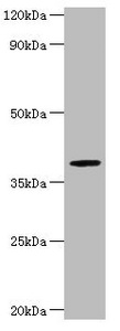 ARSB / Arylsulfatase B Antibody - Western blot All Lanes: Arylsulfatase B antibody at 2ug/ml+mouse brain tissue Secondary Goat polyclonal to Rabbit lgG at 1/15000 dilution Predicted band size: 60,46 kDa Observed band size: 40 kDa