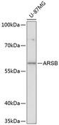 ARSB / Arylsulfatase B Antibody - Western blot analysis of extracts of U-87MG cells using ARSB Polyclonal Antibody at dilution of 1:3000.