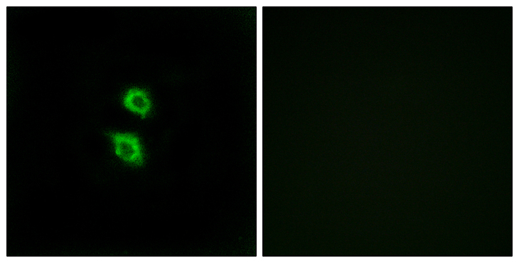 ARSD / Arylsulfatase D Antibody - Immunofluorescence analysis of MCF7 cells, using ARSD Antibody. The picture on the right is blocked with the synthesized peptide.