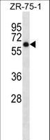 ARSD / Arylsulfatase D Antibody - ARSD Antibody western blot of ZR-75-1 cell line lysates (35 ug/lane). The ARSD antibody detected the ARSD protein (arrow).