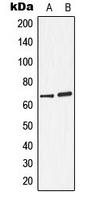 ARSD / Arylsulfatase D Antibody - Western blot analysis of Arylsulfatase D expression in A549 (A); ZR751 (B) whole cell lysates.