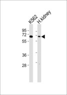 ARSD / Arylsulfatase D Antibody - All lanes : Anti-Arylsulfatase D Antibody at 1:1000 dilution Lane 1: K562 whole cell lysates Lane 2: human kidney lysates Lysates/proteins at 20 ug per lane. Secondary Goat Anti-Rabbit IgG, (H+L),Peroxidase conjugated at 1/10000 dilution Predicted band size : 65 kDa Blocking/Dilution buffer: 5% NFDM/TBST.