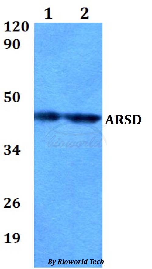 ARSD / Arylsulfatase D Antibody - Western blot of ARSD antibody at 1:500 dilution. Lane 1: MCF-7 whole cell lysate. Lane 2: sp2/0 whole cell lysate.
