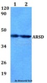 ARSD / Arylsulfatase D Antibody - Western blot of ARSD antibody at 1:500 dilution. Lane 1: MCF-7 whole cell lysate. Lane 2: sp2/0 whole cell lysate.