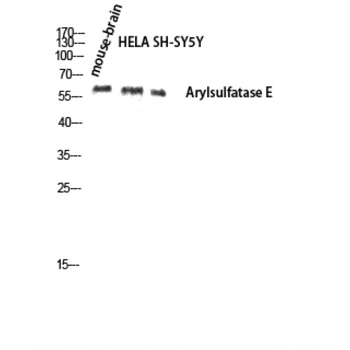 ARSE / Arylsulfatase E Antibody - Western blot of Arylsulfatase E antibody