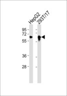 ARSE / Arylsulfatase E Antibody - All lanes : Anti-Arylsulfatase E Antibody at 1:1000 dilution Lane 1: HepG2 whole cell lysates Lane 2: 293T/17 whole cell lysates Lysates/proteins at 20 ug per lane. Secondary Goat Anti-Rabbit IgG, (H+L),Peroxidase conjugated at 1/10000 dilution Predicted band size : 66 kDa Blocking/Dilution buffer: 5% NFDM/TBST.
