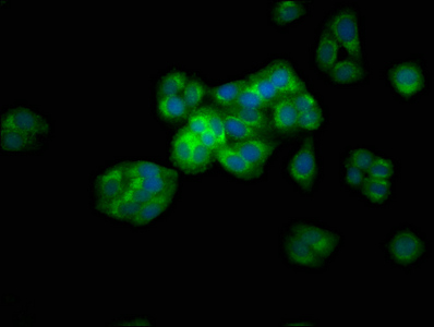 ARSE / Arylsulfatase E Antibody - Immunofluorescence staining of HepG2 cells at a dilution of 1:133, counter-stained with DAPI. The cells were fixed in 4% formaldehyde, permeabilized using 0.2% Triton X-100 and blocked in 10% normal Goat Serum. The cells were then incubated with the antibody overnight at 4 °C.The secondary antibody was Alexa Fluor 488-congugated AffiniPure Goat Anti-Rabbit IgG (H+L) .