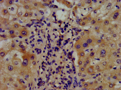 ARSE / Arylsulfatase E Antibody - Immunohistochemistry image at a dilution of 1:400 and staining in paraffin-embedded human liver tissue performed on a Leica BondTM system. After dewaxing and hydration, antigen retrieval was mediated by high pressure in a citrate buffer (pH 6.0) . Section was blocked with 10% normal goat serum 30min at RT. Then primary antibody (1% BSA) was incubated at 4 °C overnight. The primary is detected by a biotinylated secondary antibody and visualized using an HRP conjugated SP system.
