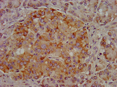 ARSE / Arylsulfatase E Antibody - Immunohistochemistry image at a dilution of 1:400 and staining in paraffin-embedded human pancreatic tissue performed on a Leica BondTM system. After dewaxing and hydration, antigen retrieval was mediated by high pressure in a citrate buffer (pH 6.0) . Section was blocked with 10% normal goat serum 30min at RT. Then primary antibody (1% BSA) was incubated at 4 °C overnight. The primary is detected by a biotinylated secondary antibody and visualized using an HRP conjugated SP system.