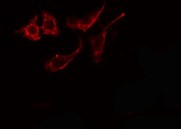 ARSE / Arylsulfatase E Antibody - Staining HeLa cells by IF/ICC. The samples were fixed with PFA and permeabilized in 0.1% Triton X-100, then blocked in 10% serum for 45 min at 25°C. The primary antibody was diluted at 1:200 and incubated with the sample for 1 hour at 37°C. An Alexa Fluor 594 conjugated goat anti-rabbit IgG (H+L) antibody, diluted at 1/600, was used as secondary antibody.
