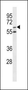 ARSF / Arylsulfatase F Antibody - ARSF Antibody western blot of K562 cell line lysates (35 ug/lane). The ARSF antibody detected the ARSF protein (arrow).