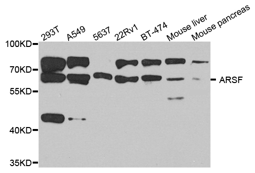 ARSF / Arylsulfatase F Antibody - Western blot analysis of extract of various cells.