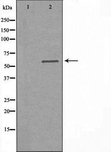 ARSF / Arylsulfatase F Antibody - Western blot analysis of extracts of COS-7 cells using ARSF antibody. The lane on the left is treated with the antigen-specific peptide.