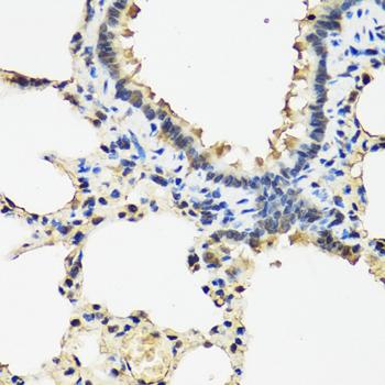 ARSF / Arylsulfatase F Antibody - Immunohistochemistry of paraffin-embedded Rat lung using ARSF Polyclonal Antibody at dilution of 1:100 (40x lens).