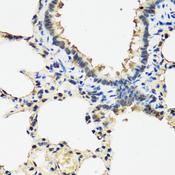 ARSF / Arylsulfatase F Antibody - Immunohistochemistry of paraffin-embedded Rat lung using ARSF Polyclonal Antibody at dilution of 1:100 (40x lens).