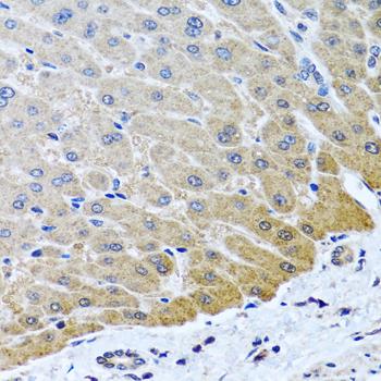 ARSF / Arylsulfatase F Antibody - Immunohistochemistry of paraffin-embedded Human liver using ARSF Polyclonal Antibody at dilution of 1:100 (40x lens).