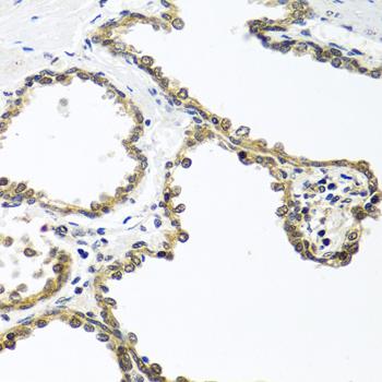 ARSF / Arylsulfatase F Antibody - Immunohistochemistry of paraffin-embedded Human prostate using ARSF Polyclonal Antibody at dilution of 1:100 (40x lens).