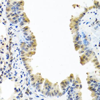 ARSF / Arylsulfatase F Antibody - Immunohistochemistry of paraffin-embedded Mouse lung using ARSF Polyclonal Antibody at dilution of 1:100 (40x lens).