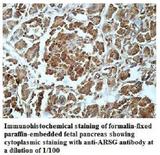 ARSG / Arylsulfatase G Antibody - Immunohistochemistry of ARSG / Arylsulfatase G antibody