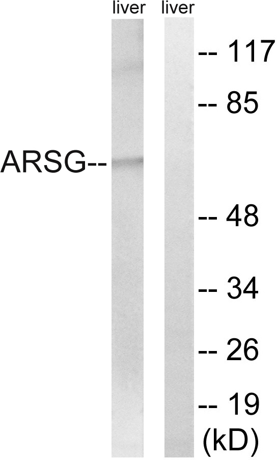 ARSG / Arylsulfatase G Antibody - Western blot analysis of lysates from mouse liver, using ARSG Antibody. The lane on the right is blocked with the synthesized peptide.