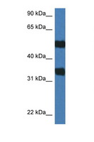 ARSG / Arylsulfatase G Antibody - ARSG antibody Western blot of Mouse Spleen lysate. Antibody concentration 1 ug/ml.  This image was taken for the unconjugated form of this product. Other forms have not been tested.