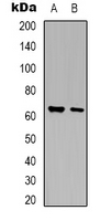 ARSG / Arylsulfatase G Antibody - Western blot analysis of Arylsulfatase G expression in HEK293T (A); mouse liver (B) whole cell lysates.