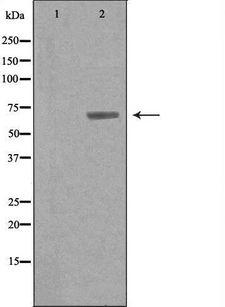 ARSG / Arylsulfatase G Antibody - Western blot analysis of extracts of mouse liver cells using ARSG antibody. The lane on the left is treated with the antigen-specific peptide.