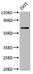 ARSH / Arylsulfatase H Antibody - Positive Western Blot detected in 293T whole cell lysate. All lanes: ARSH antibody at 5.2 µg/ml Secondary Goat polyclonal to rabbit IgG at 1/50000 dilution. Predicted band size: 64 KDa. Observed band size: 64 KDa