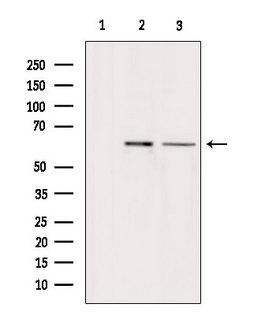 ARSH / Arylsulfatase H Antibody - Western blot analysis of extracts of various samples using ARSH antibody. Lane 1: HepG2 treated with blocking peptide. Lane 2: HepG2; Lane 3: mouse brain;