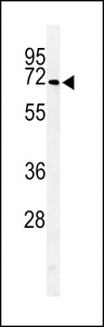 ARSI / Arylsulfatase I Antibody - Western blot of ARSI Antibody in HepG2 cell line lysates (35 ug/lane). ARSI (arrow) was detected using the purified antibody.