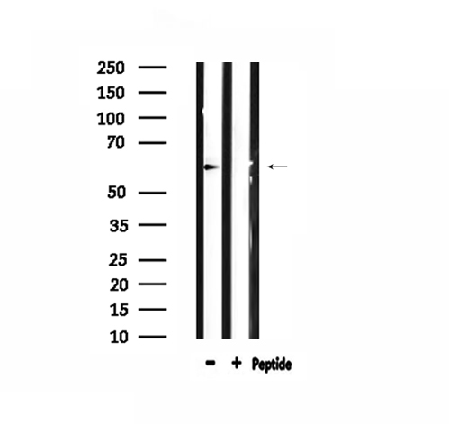 ARSI / Arylsulfatase I Antibody - Western blot analysis of extracts of HeLa cells using ARSI antibody.