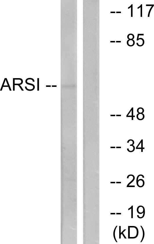 ARSI / Arylsulfatase I Antibody - Western blot analysis of extracts from COS7 cells, using ARSI antibody.