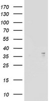 ART1 /CD296 Antibody - HEK293T cells were transfected with the pCMV6-ENTRY control (Left lane) or pCMV6-ENTRY ART1 (Right lane) cDNA for 48 hrs and lysed. Equivalent amounts of cell lysates (5 ug per lane) were separated by SDS-PAGE and immunoblotted with anti-ART1.