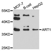 ART1 /CD296 Antibody - Western blot analysis of extracts of various cell lines, using ART1 antibody at 1:1000 dilution. The secondary antibody used was an HRP Goat Anti-Rabbit IgG (H+L) at 1:10000 dilution. Lysates were loaded 25ug per lane and 3% nonfat dry milk in TBST was used for blocking. An ECL Kit was used for detection and the exposure time was 90s.