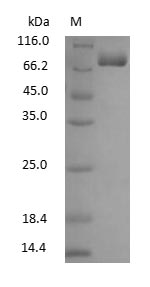 ART1 /CD296 Protein - (Tris-Glycine gel) Discontinuous SDS-PAGE (reduced) with 5% enrichment gel and 15% separation gel.