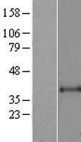 ART1 /CD296 Protein - Western validation with an anti-DDK antibody * L: Control HEK293 lysate R: Over-expression lysate