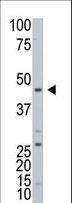 ART3 Antibody - Western blot of ART3 Antibody in HL60 cell line lysates (25 ug/lane). ART3(arrow) was detected using the purified antibody (4 ug/ml).