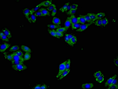 ART3 Antibody - Immunofluorescent analysis of HepG2 Cells Cells at a dilution of 1:100 and Alexa Fluor 488-congugated AffiniPure Goat Anti-Rabbit IgG(H+L)